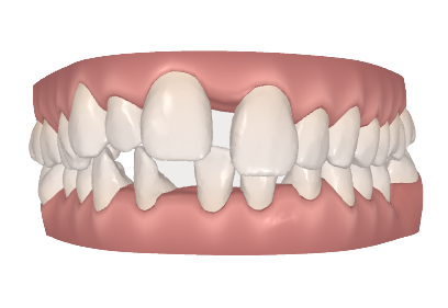 prima removebg preview - Clinica Odontoiatrica Mancini