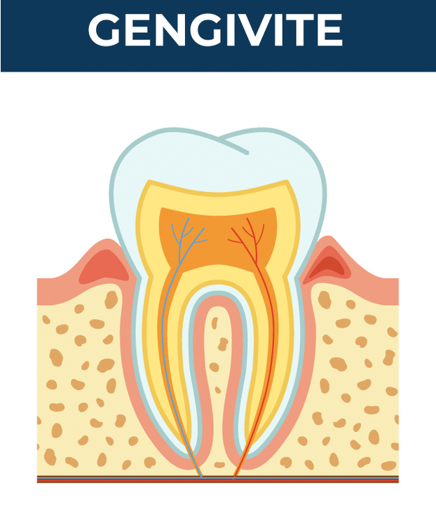 49077790 0 Webp.net gifmaker 2 - Clinica Odontoiatrica Mancini