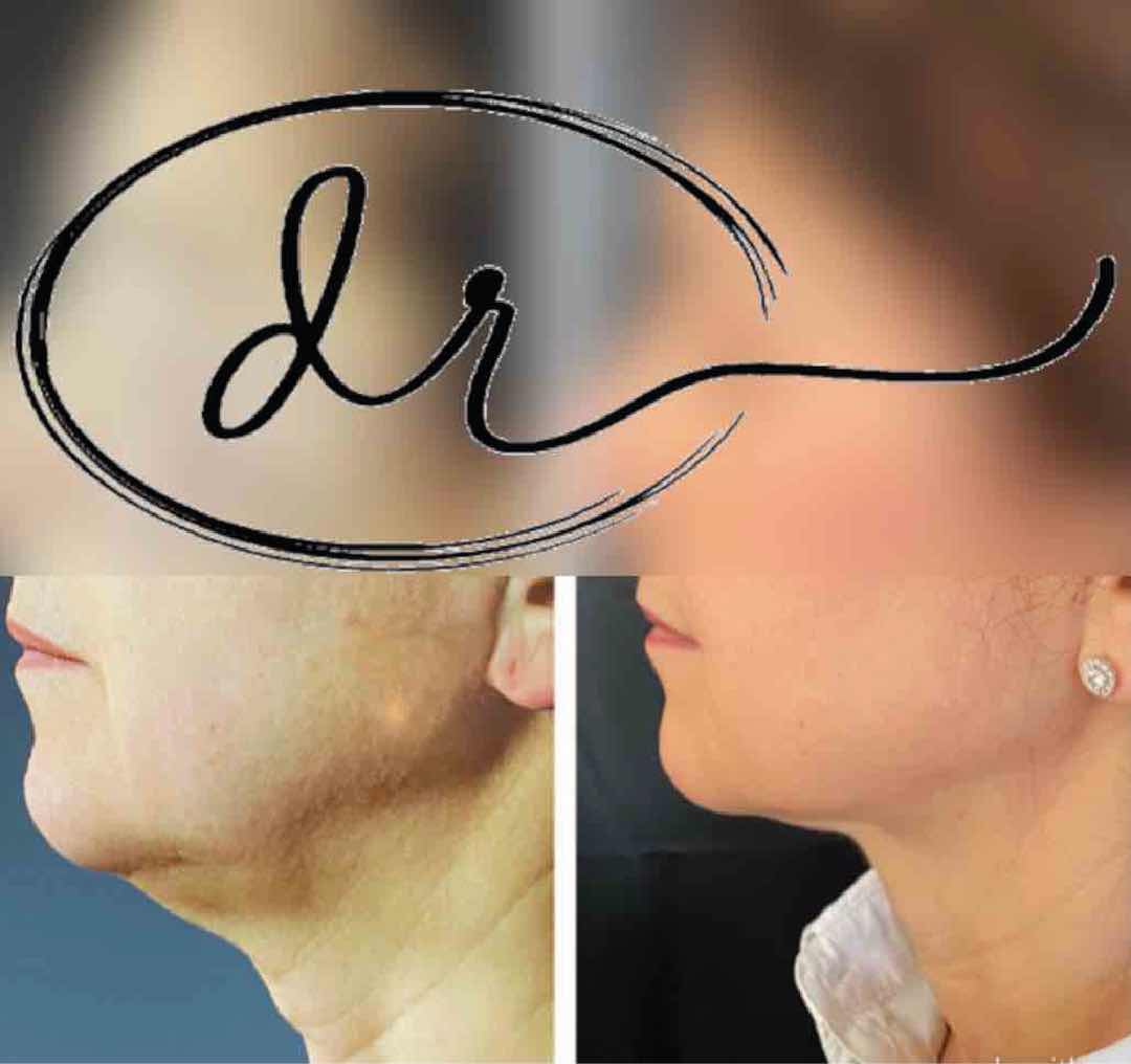 Landing Medicina Estetica 12 - Clinica Odontoiatrica Mancini Risorsa 10
