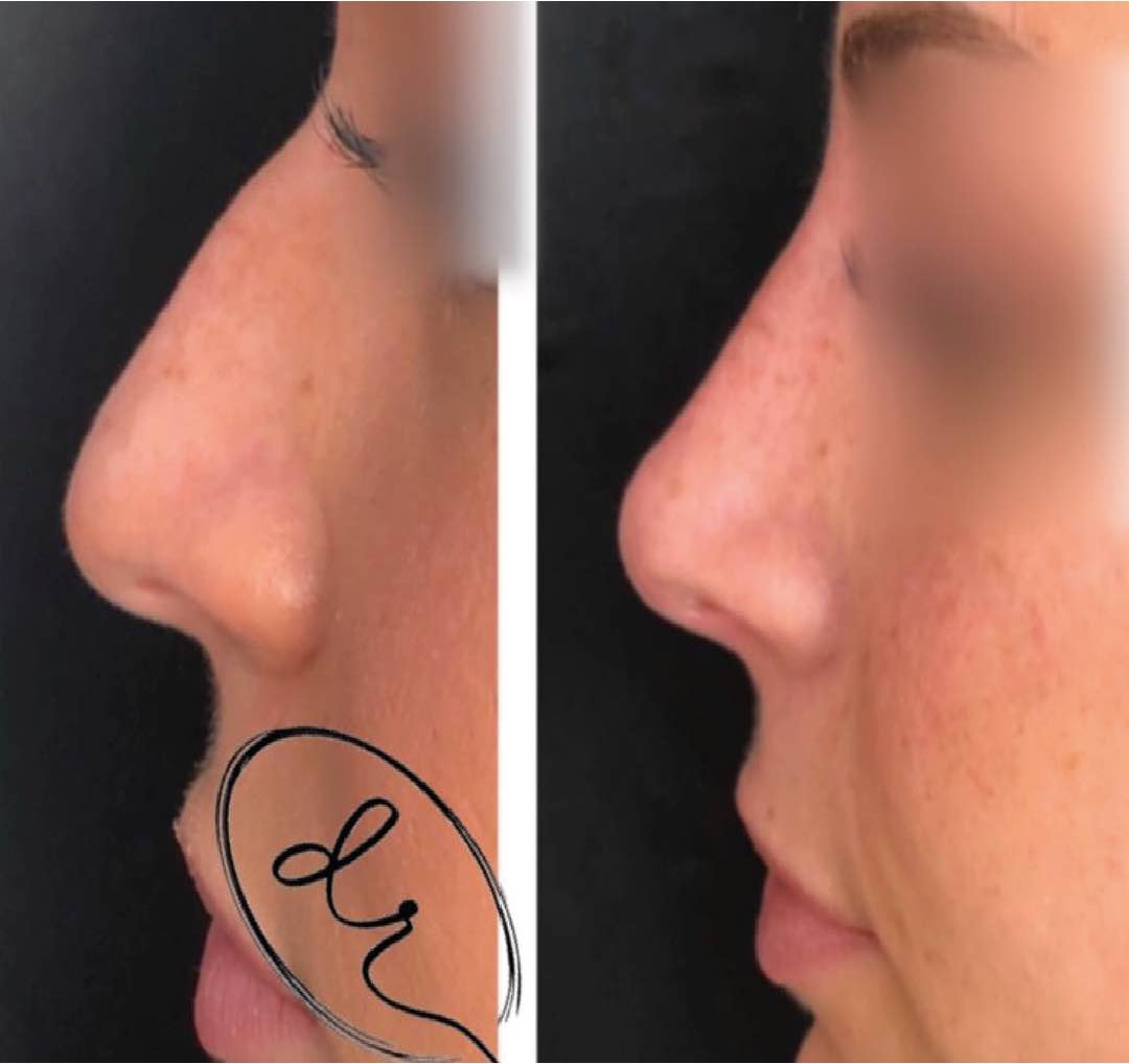Landing Medicina Estetica 14 - Clinica Odontoiatrica Mancini Risorsa 11